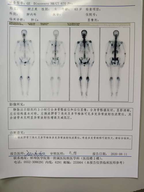 骨扫描后隔离几米安全