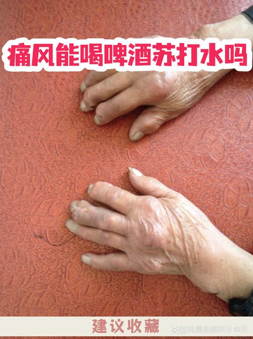 痛风喝什么牌子苏打水