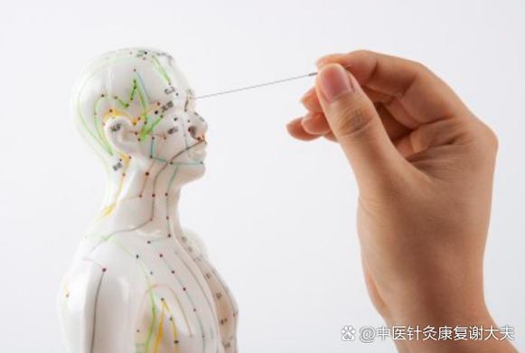 开封针灸面部哪里好