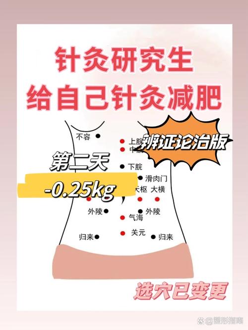 针灸肚子减肥有效吗