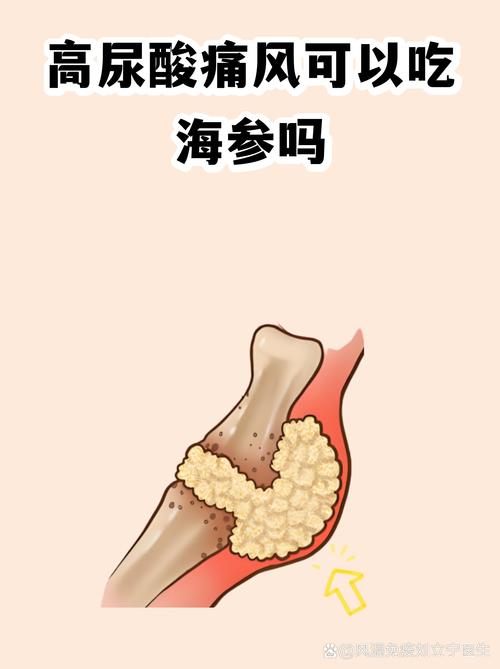 痛风患者可以吃海参吗