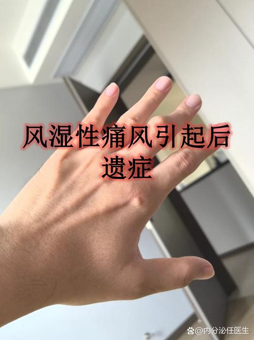 痛风伤口不愈合怎么办