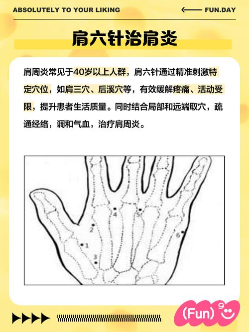 针灸那些地方不能扎
