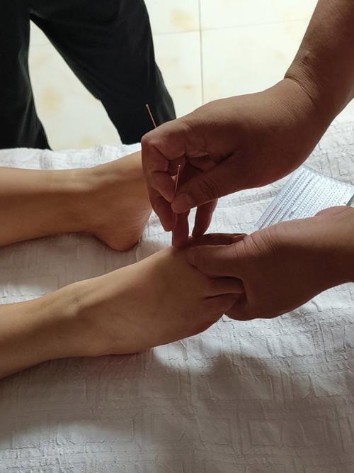 哈尔滨哪里能学针灸