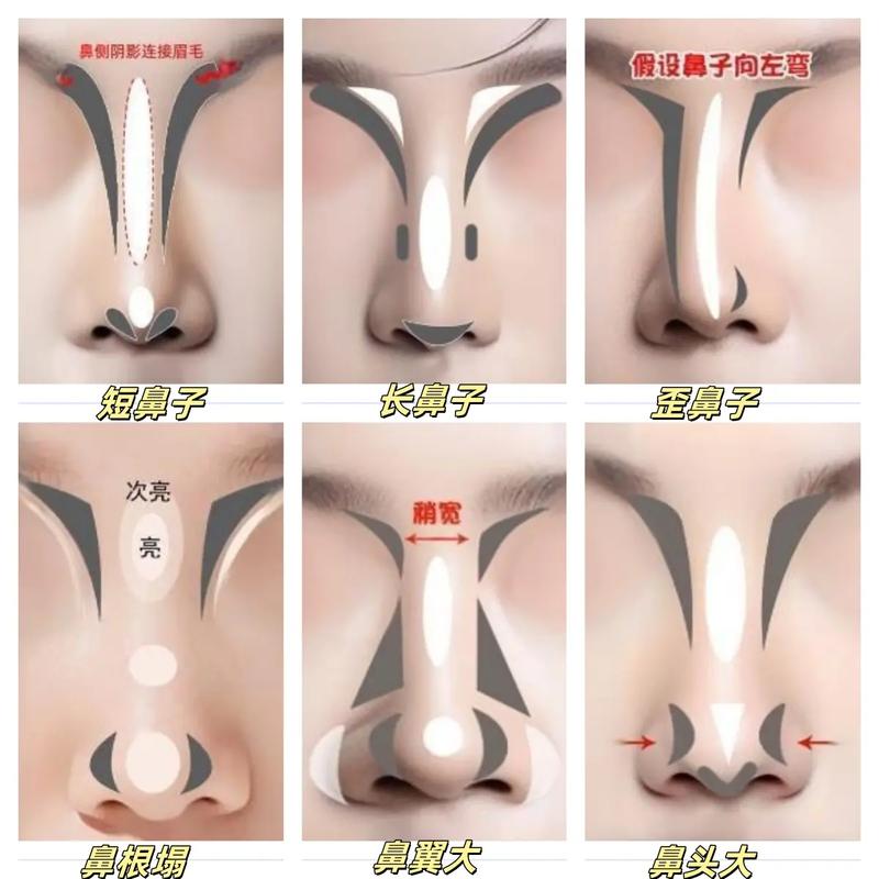 永久隆鼻最安全的方法