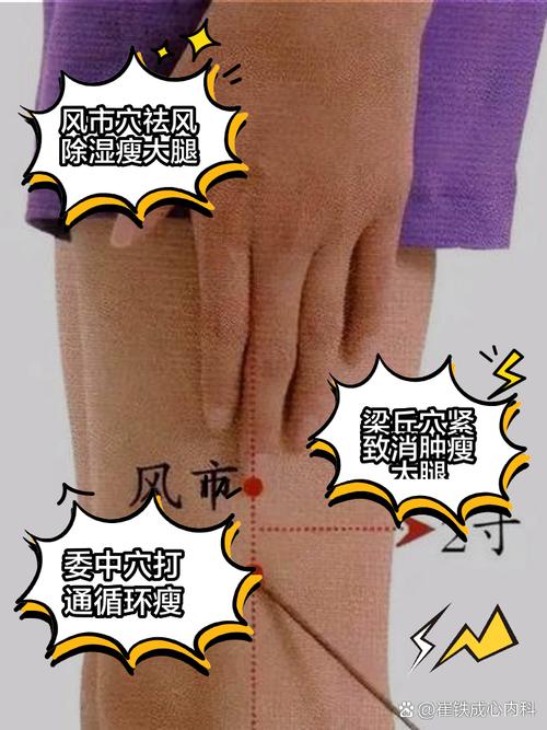 宿迁哪里有针灸减肥