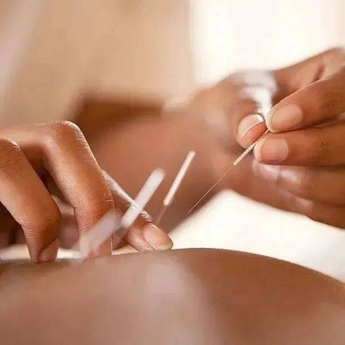 出了月子可以针灸吗