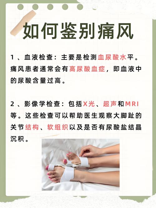 痛风脚趾头疼怎么缓解