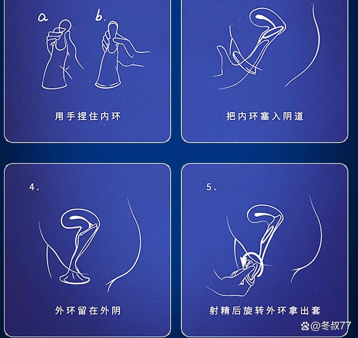 女性最安全的避孕方式