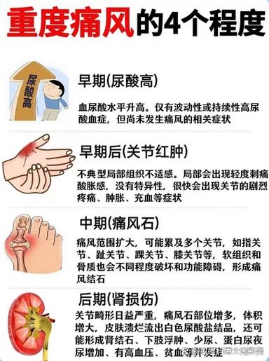 诱发痛风的原因有哪些