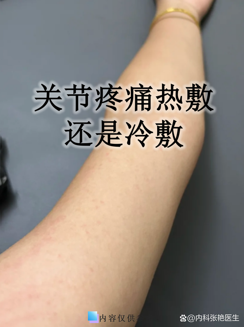 痛风应该冷敷还是热敷