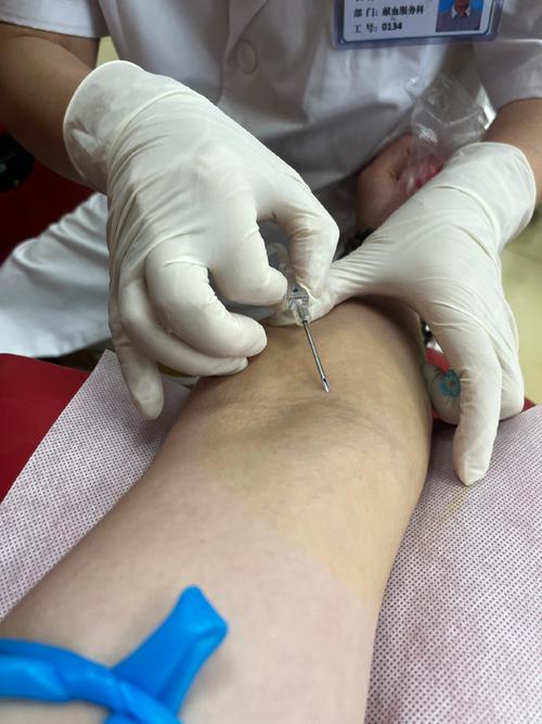 针灸减肥 下体流血