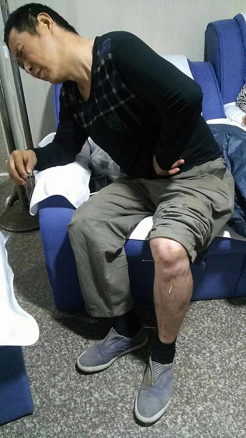 输尿管结石针灸行吗