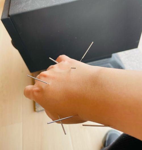 西医没有正骨 针灸
