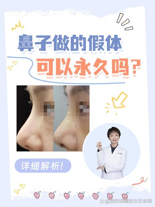 做鼻子那种最安全永久