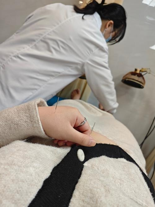 不孕不育 女子针灸