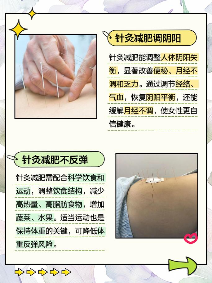 针灸减肥 乌鲁木齐