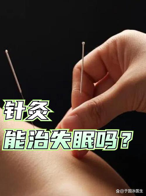 针灸晚上可以针灸吗