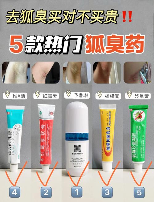 太原治疗狐臭惠明安全