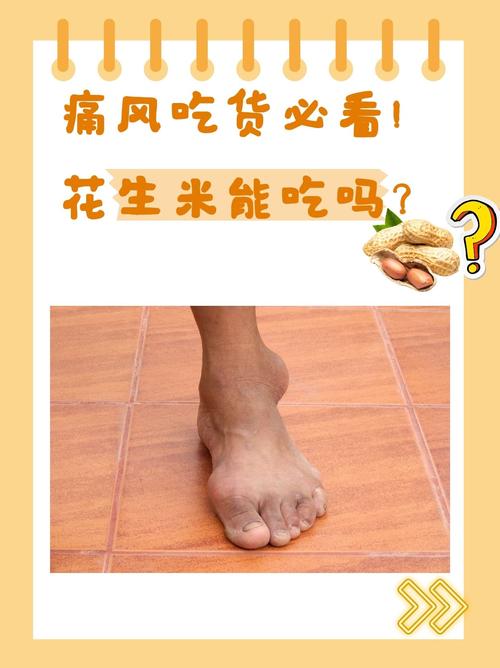 痛风的人可以吃花生吗