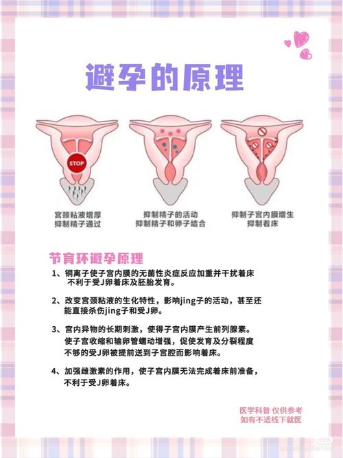 不上环怎样避孕最安全