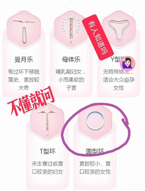 不上环怎样避孕最安全