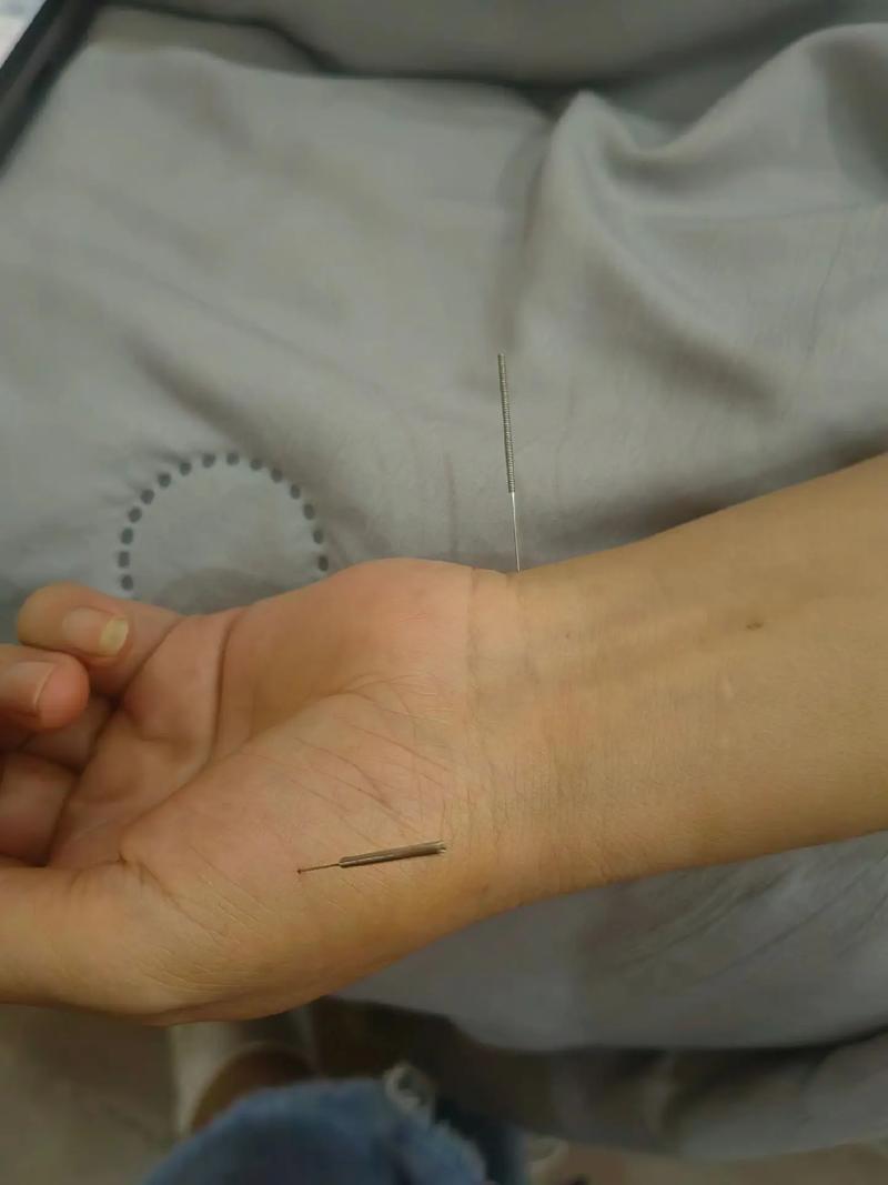 杨甲三针灸教学视频