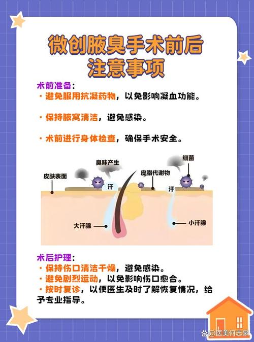 太原腋臭医院惠明安全