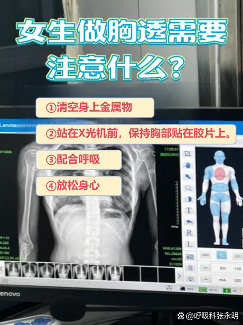 床边胸片辐射多远安全