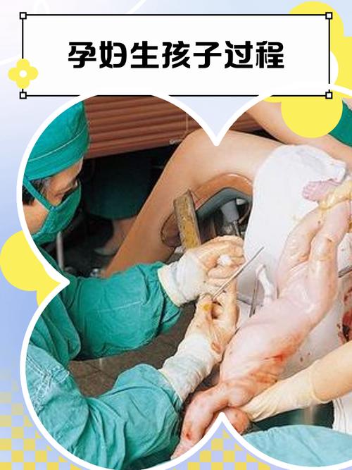 宫口全开多久生是安全