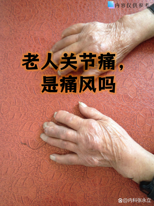 痛风是骨头痛还是肉痛