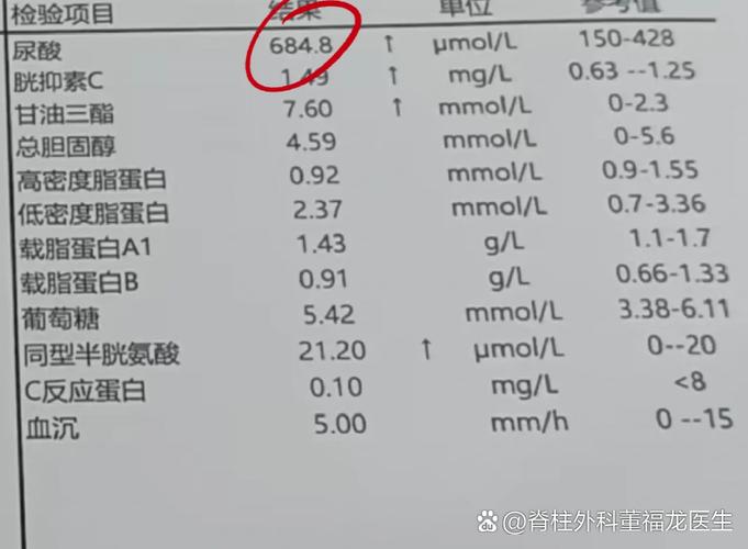 确诊痛风检查哪些项目