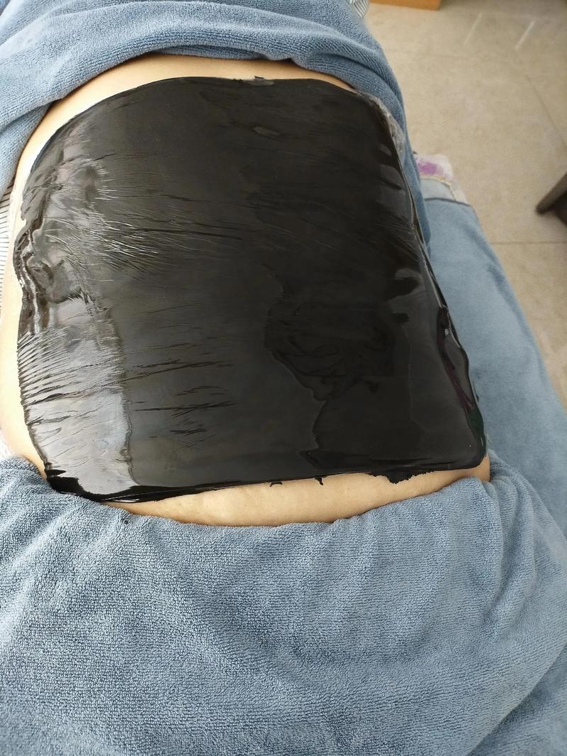 针灸完在泥灸可以吗