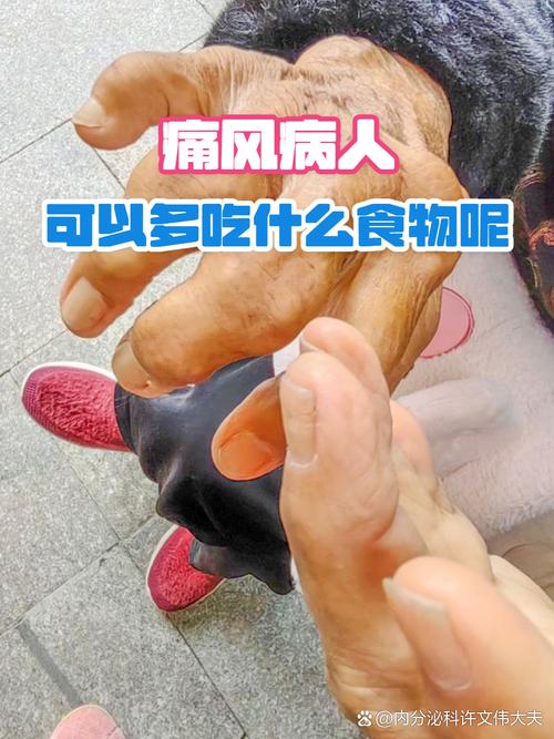 痛风能吃鸡精和味精吗