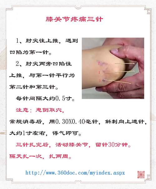 膝关节痛针灸管用吗