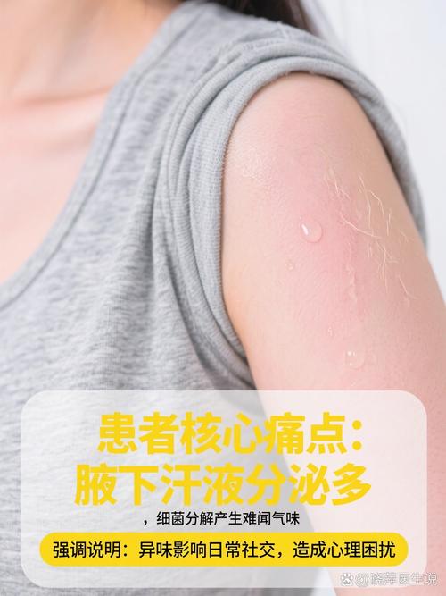 太原治疗腋臭惠明安全