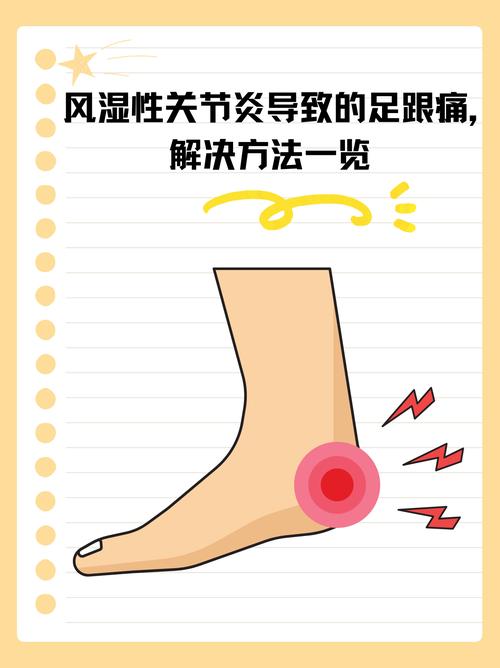 痛风会引起脚后跟疼吗