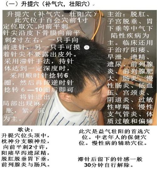 平衡针灸失三针是啥