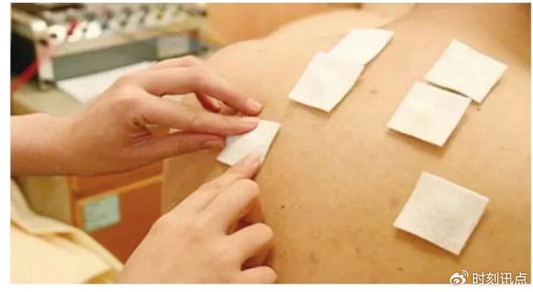 东城中医医院针灸科