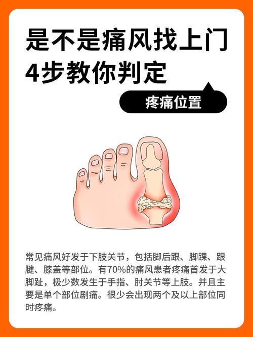 痛风性关节炎诊断标准