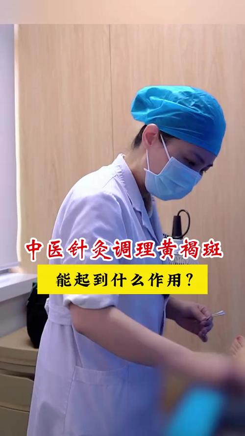 针灸可以去黄褐斑吗