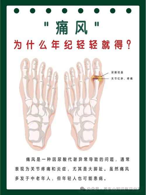 痛风反复发作什么原因