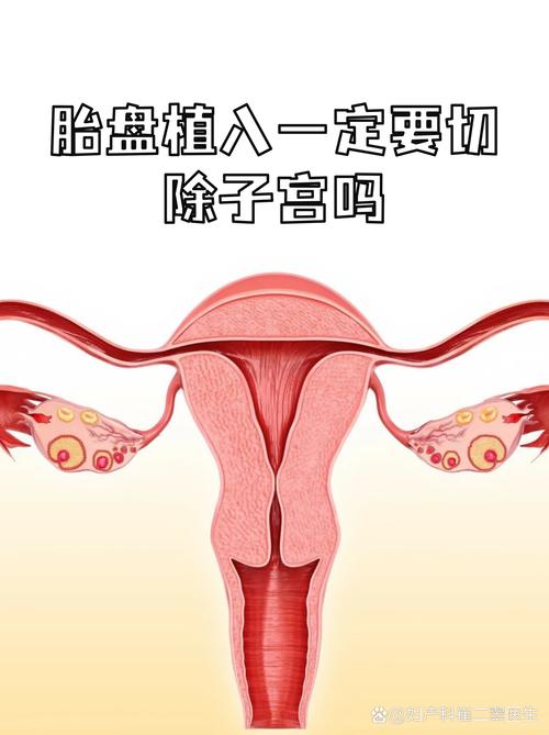 胎盘植入面积多少安全