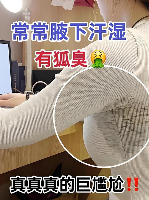 上海狐臭治疗虹桥安全