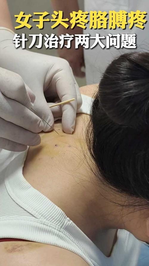 针灸和小针刀哪个疼