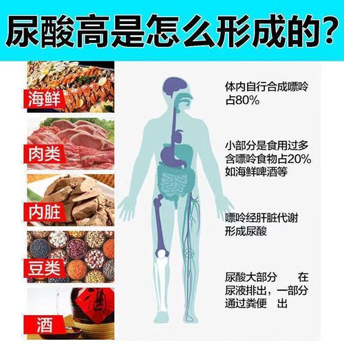 碳酸氢钠对痛风的作用