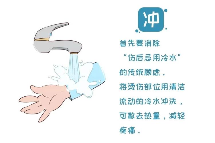 如何防止烫伤安全知识