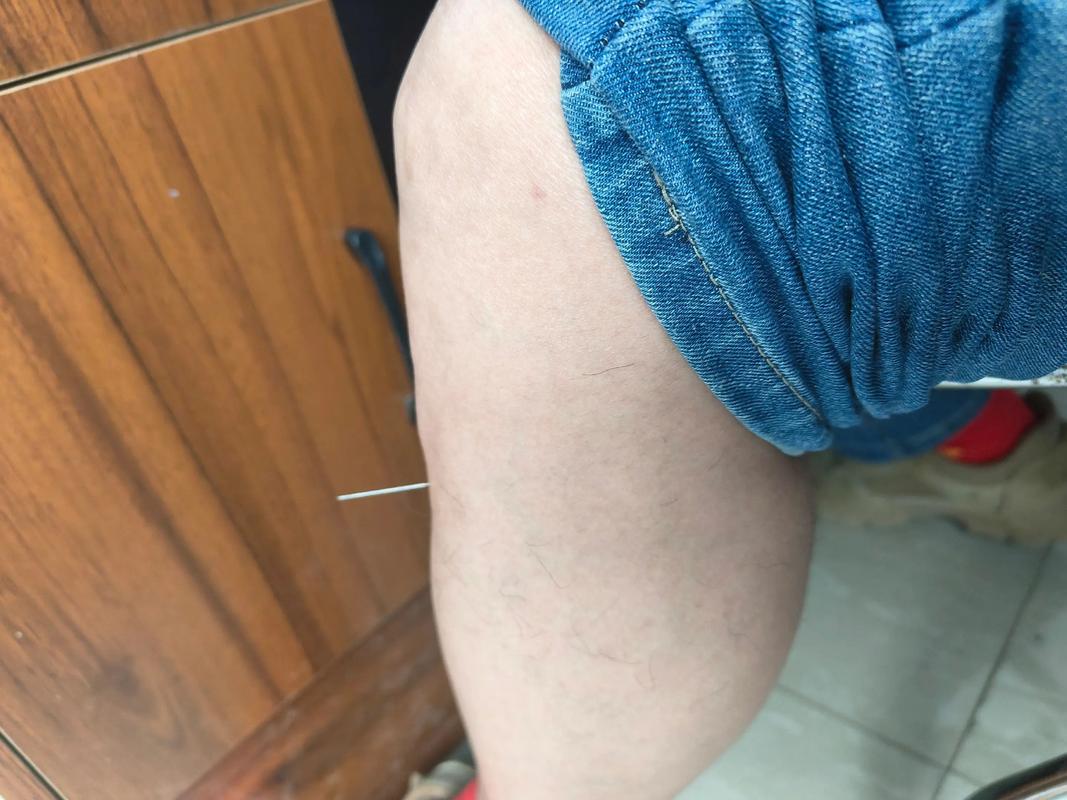 针灸足三里留针多久