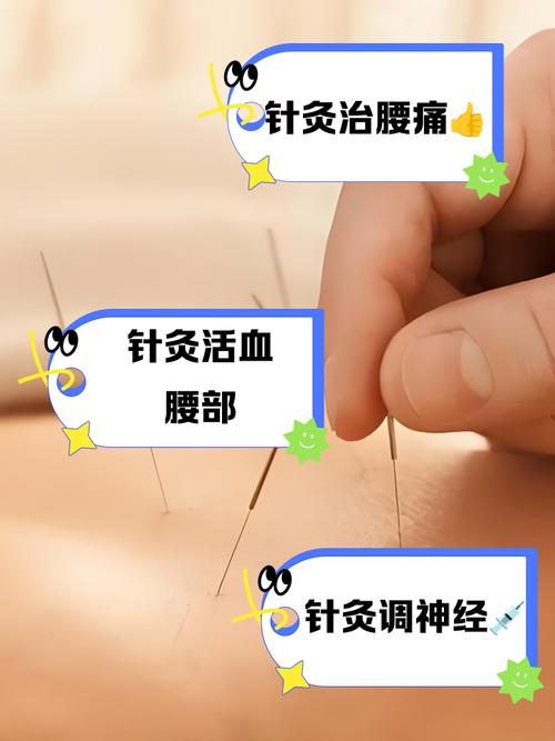 腰突针灸后要休息吗