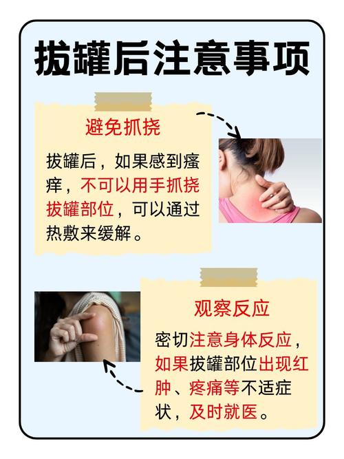 针灸拔罐后能洗头吗